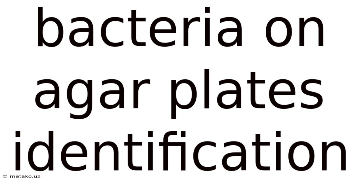Bacteria On Agar Plates Identification