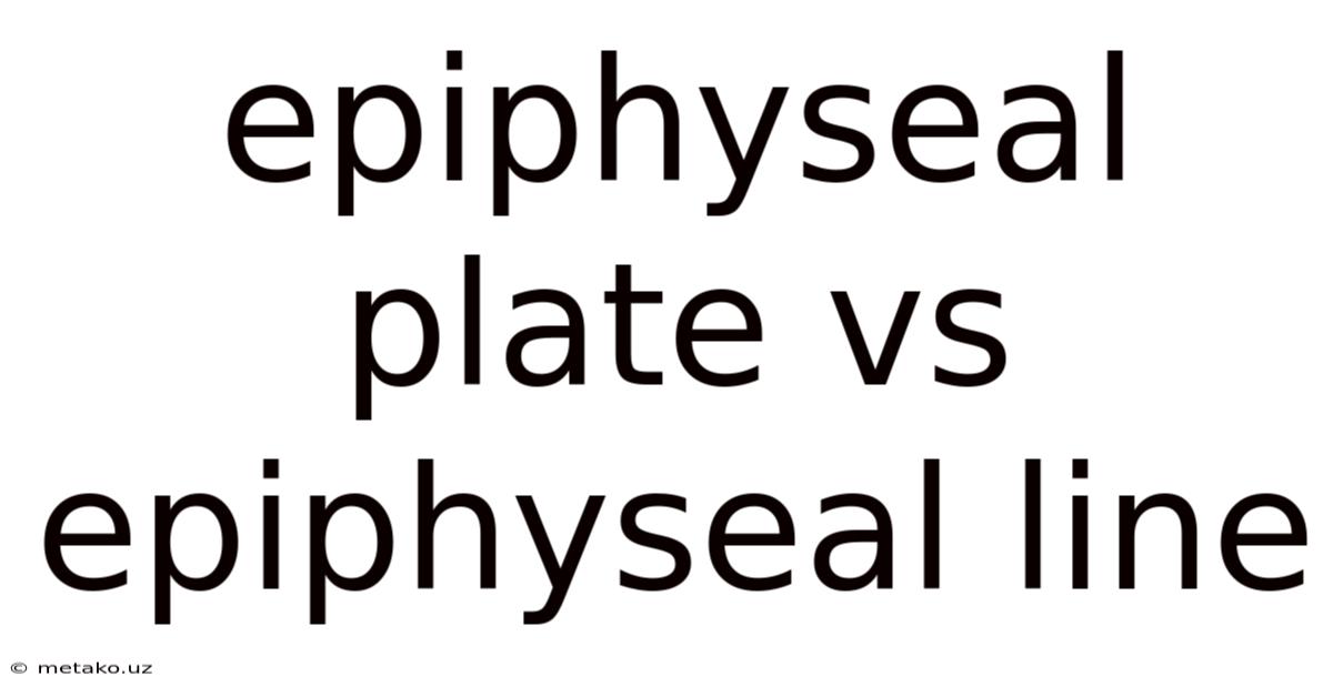 Epiphyseal Plate Vs Epiphyseal Line