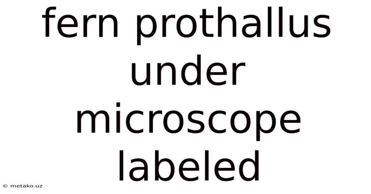 Fern Prothallus Under Microscope Labeled