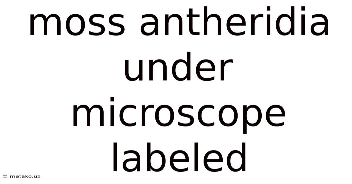 Moss Antheridia Under Microscope Labeled